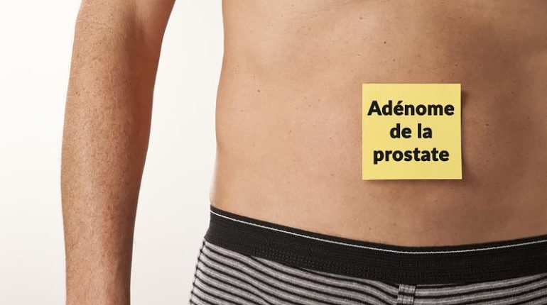 adenome-prostate-slip